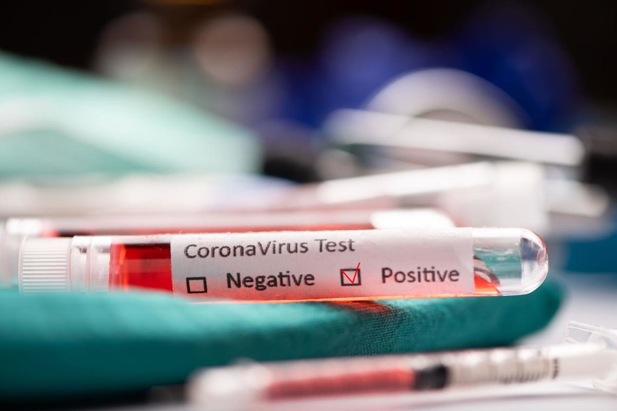 Tests confirmed 3 new COVID-19 cases in Bermuda