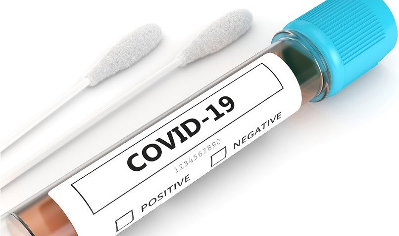 No new COVID-19 cases in Bermuda; 134 have recovered