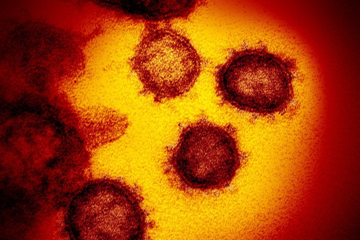 Uncertain future as Covid-19 infection rate sets global records
