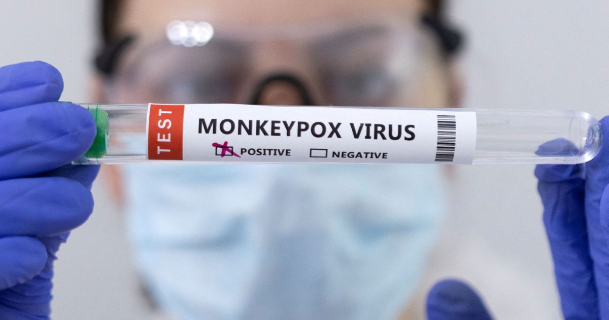 Slovenia, Czech Republic register first monkeypox cases